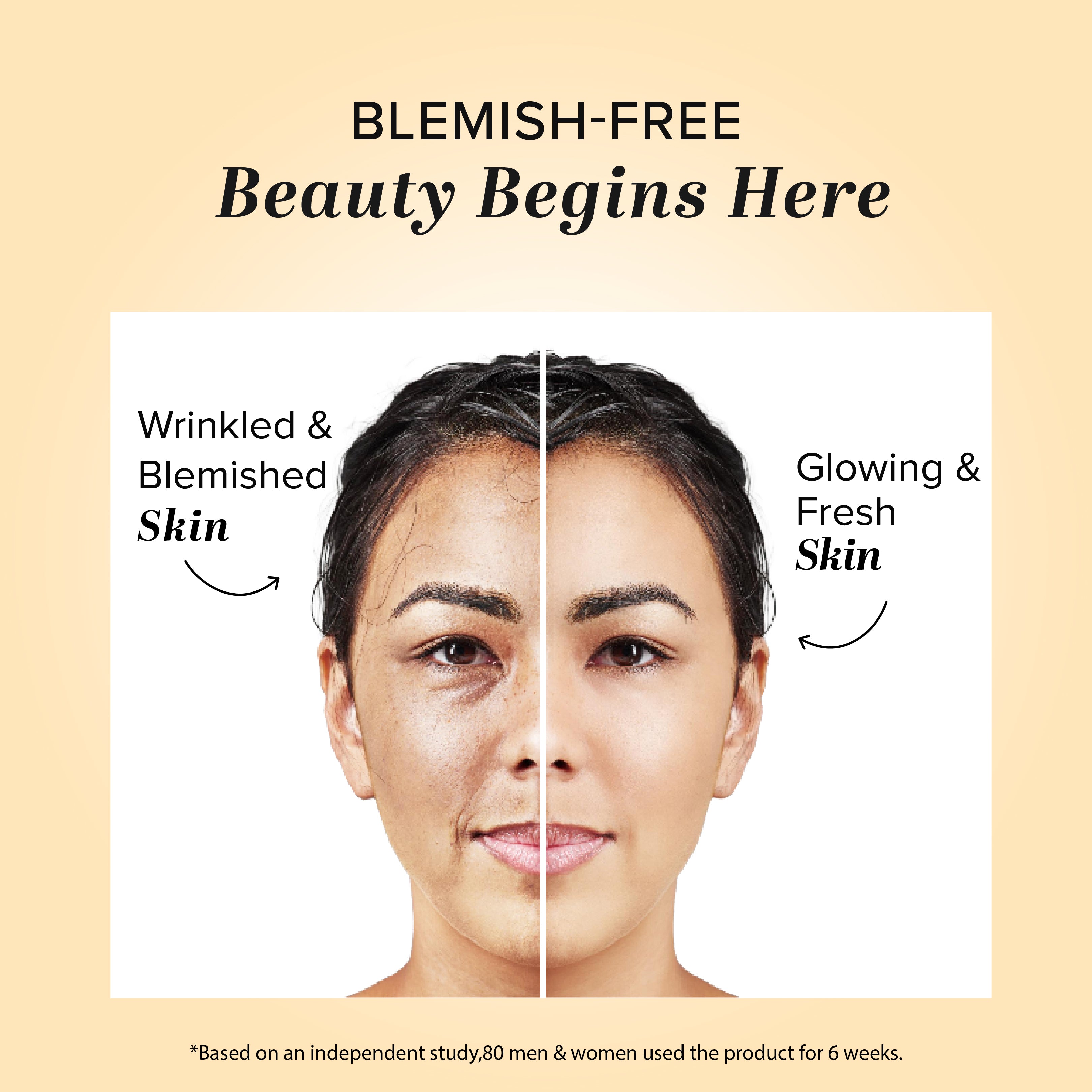 Khadi Natural Herbal Anti Blemish Cream - 50gm